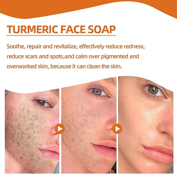 Turmeric & Kojic Soap